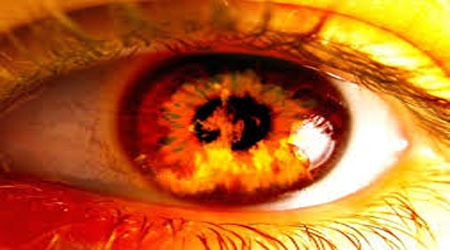 آثار و پیامدهای سوء  آثار و پیامدهای سوء