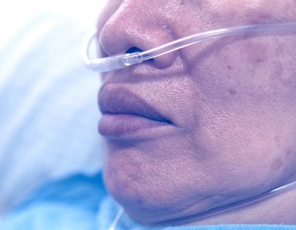 مهلک‌ترین علائم کرونا که پس از مشاهده باید به بیمارستان مراجعه کرد