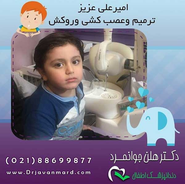 جلوگیری و درمان پوسیدگی دندان در کودکان جلوگیری و درمان پوسیدگی دندان در کودکان