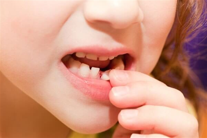 دندانی که ابتدا در می آید زودتر می افتد دندان های شیری کودکان باعث می شوند تا کودک بتواند بهتر صحبت کند و غذاهایش را بجود.