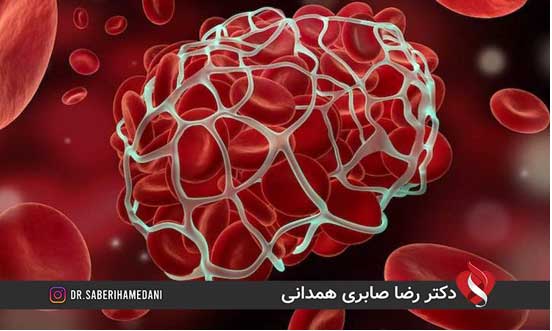 عوارض بعد از بالن زدن قلب عوارض بعد از بالن زدن قلب
