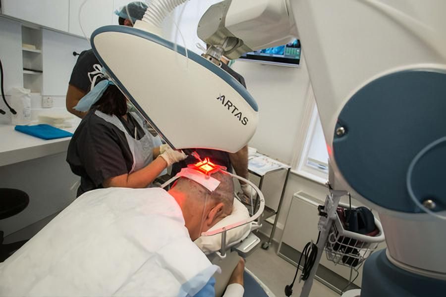 با جدیدترین روش کاشت موی جهان آشنا شوید !