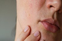7 راهکار خارق العاده برای جلوگیری از ایجاد منافذ بر روی پوست