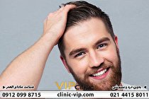 آیا نتایج کاشت مو دایمی است چه مدت بعد از کاشت مو میتوانید به نتیجه دلخواه برسید