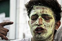 پوست دچار سوختگی ترمیم کامل نمی‌شود