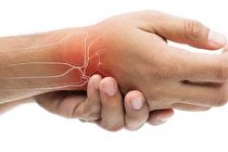آلودگی هوا عامل جدید ابتلا به روماتیسم مفصلی