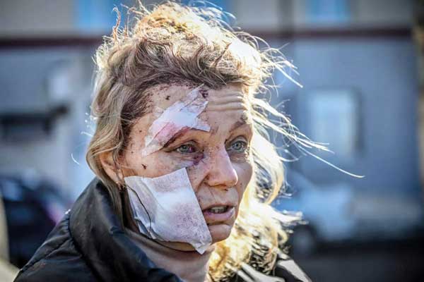 تا کی بـاید برای زنـدگی بجنگیم؟ (گزارش تصویری)