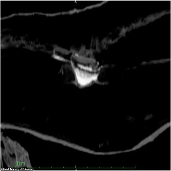 این زن مومیایی باردار است (تصاویر) این زن مومیایی باردار است (تصاویر)