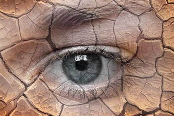 یکی از آزاردهنده‌ترین بیماری‌های سطح چشم، احساس وجود جسم خارجی و سوزش و خارش کلافه‌ کننده ناشی از آن است.