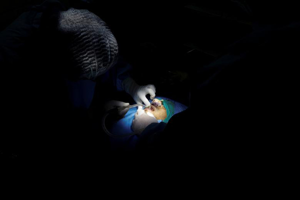 جراحی بر روی بیمار مبتلا به قارچ سیاه / کودکان یخی (گزارش تصویری) جراحی بر روی بیمار مبتلا به قارچ سیاه / کودکان یخی (گزارش تصویری)