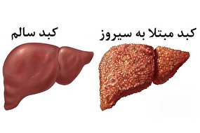 تاثیر عصاره میوه نسترن وحشی در پیشگیری از سیروز کبدی