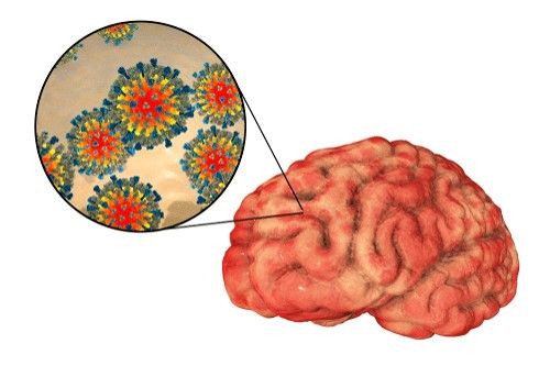 سرخک چیست (شایع‌ترین بیماری عفونی از طریق تنفس) و چه درمانی دارد؟