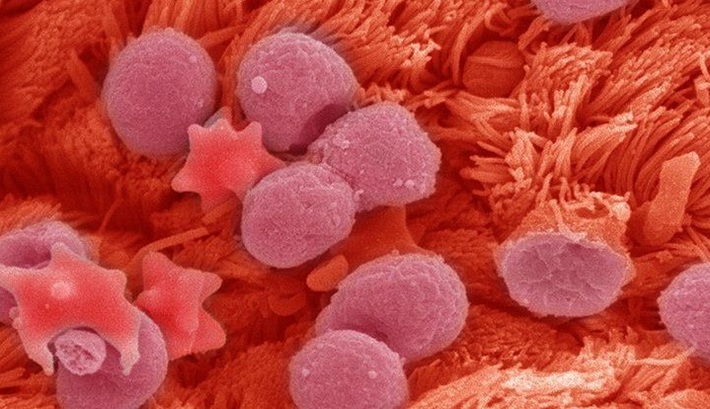 در گزارشی که از نتایج اولیه یک مطالعه تحقیقاتی منتشر شده است، دانشمندان موفق شده‌اند با استفاده از فناوری تصحیح ژنی کریسپر، مانع از گسترش عفونت و تکثیر ویروس سارس-کوو ۲ در کشت سلول‌های انسانی شده‌اند.