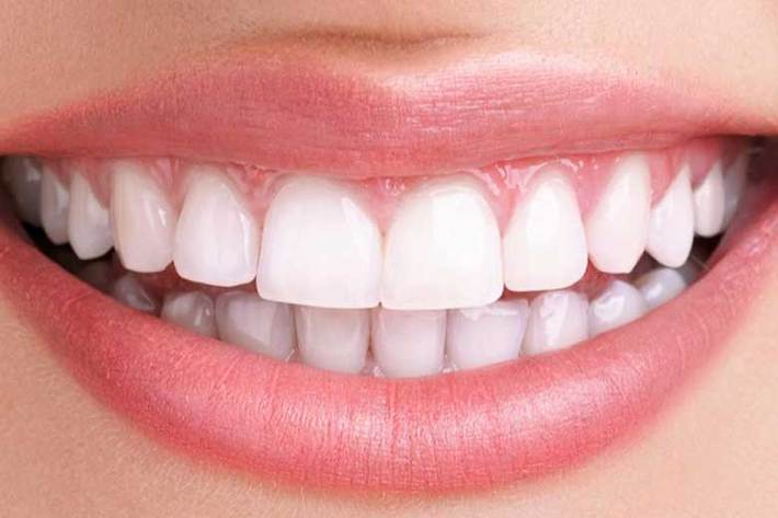 مواد غذایی مفید برای سلامت دهان و دندان را بشناسید