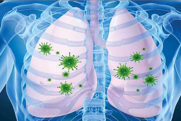 مدیر بخش اورژانس بیمارستان سینا درباره اهمیت فیزیوتراپی برای افراد کرونایی که ریه های آنها درگیر شده است، توضیحاتی ارائه داد.