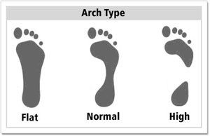 کف پای صاف چیست؟