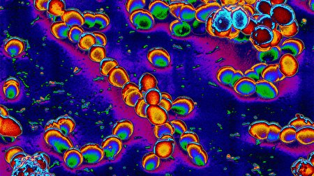 کشف یک باکتری برای مقابله با پیری