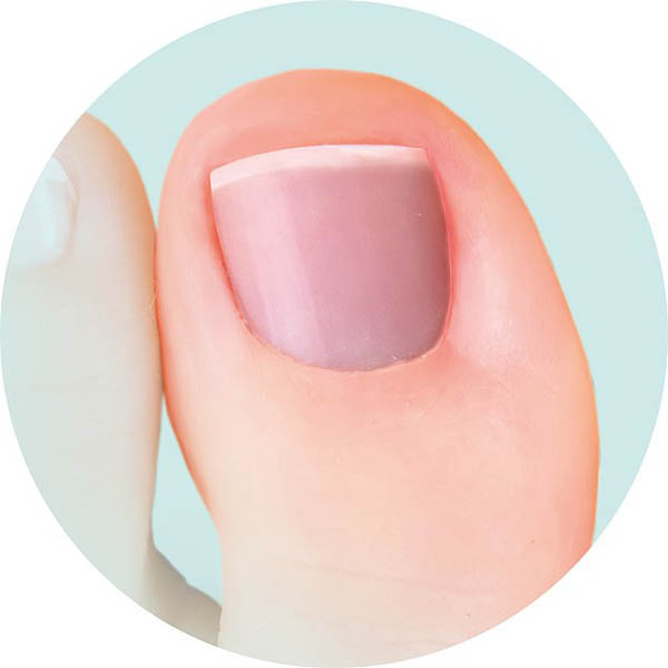 ناخن های پا در مورد سلامتی شما چه می گویند؟ (تصاویر) ناخن های پا در مورد سلامتی شما چه می گویند؟ (تصاویر)