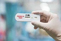 آزمایش فوری و کم‌هزینه برای تشخیص کرونا