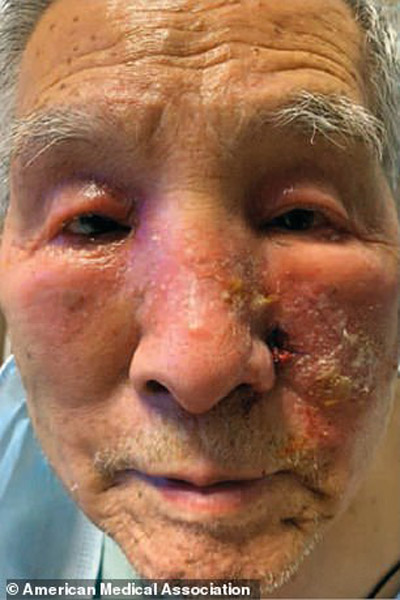 بلایی که واکسن مدرنا سر این 2 مرد آورد (عکس)