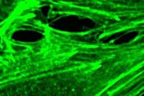 کشف عامل اصلی نشت رگ‌ های خونی