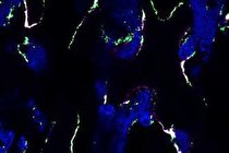 کشف پروتئینی برای درمان پوکی استخوان