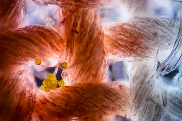 تصاویری شگفت انگیز و برگزیده از مسابقه «میکروگرافی» (گزارش تصویری) تصاویری شگفت انگیز و برگزیده از مسابقه «میکروگرافی» (گزارش تصویری)