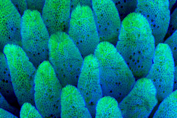 تصاویری شگفت انگیز و برگزیده از مسابقه «میکروگرافی» (گزارش تصویری) تصاویری شگفت انگیز و برگزیده از مسابقه «میکروگرافی» (گزارش تصویری)