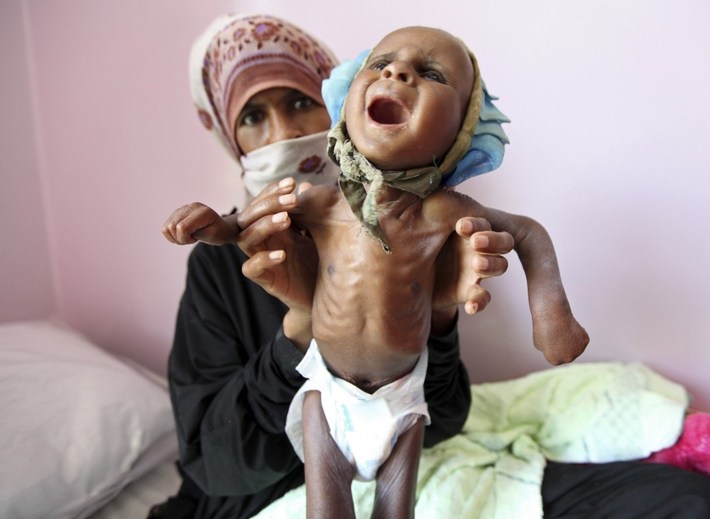 حمایت کمیته امداد کرمان از 19 هزار مادر باردار و کودک مبتلابه سوءتغذیه