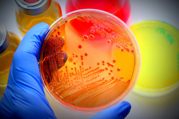 بر اساس یک مطالعه جدید ترکیب یک ویروس کشنده برای باکتری‌ها به همراه آنتی‌بیوتیک می‌تواند در از بین بردن باکتری‌های مقاوم به آنتی‌بیوتیک موثر باشد.