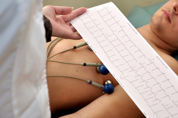 محققان مشاهده کرده‌اند که کاهش در یکی از فعالیت‌های الکتریکی قلب، می‌تواند احتمال مرگ بر اثر کرونا را حدود ۵۲ ساعت قبل از وقوع مشخص کند.