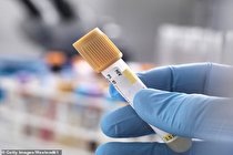 درمان بیماری های ابولا و ایدز با کمک ژن میمون