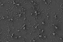 مقابله با باکتری‌ ها به کمک داروی زنده