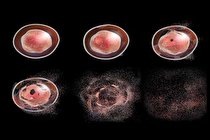 مرگ برنامه ریزی شده سلول چیست؟