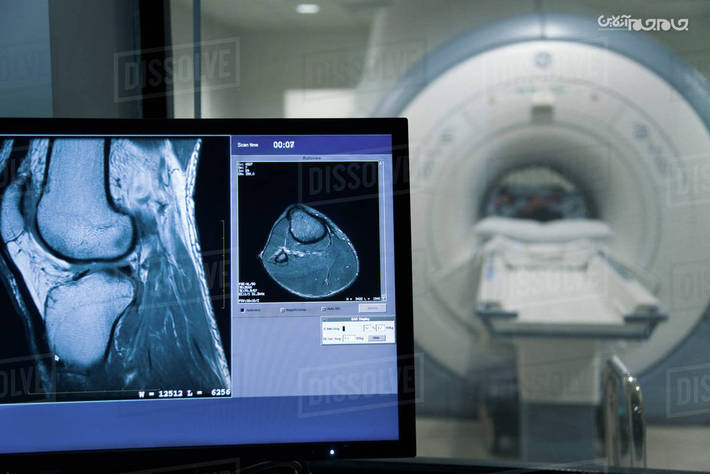 مدیر درمان تامین اجتماعی استان اردبیل از استقرار دستگاه MRI در بیمارستان سبلان اردبیل خبر داد.