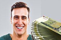 6 روش تضمینی برای کاهش هزینه ارتودنسی دندان