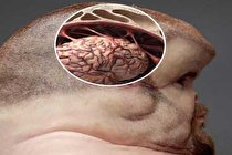 چگونه می‌توانیم از یک تصادف رانندگی مرگبار نجات پیدا کنیم؟