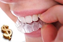 قیمت ارتودنسی نامرئی در سال 1400 چقدر است؟