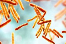 علل ژنتیکی مقاومت دارویی در بیماری سل شناسایی شد