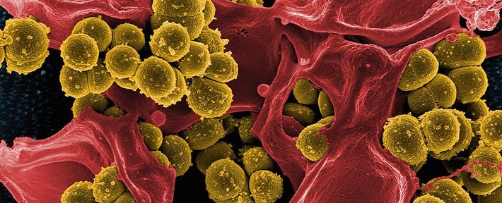 پر کردن جیب میکروب‌ها با طلا می‌تواند راهی مفید برای پایان دادن به عفونت باشد. شاید کمی عجیب به نظر برسد، اما دانشمندان در حال تلاش برای تبدیل این یافته به درمانی ضد میکروبی عملی هستند.