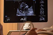 انجام سونوگرافی می‌تواند برای جنین مضر باشد؟