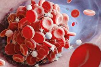 پشت‌ پرده لخته خونی پس از واکسن آسترازنکا