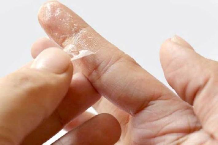 ‌می‌توانید برای پاک کردن چسب قطره‌ای از روی پوست دست از استون یا نمک و آب گرم استفاده کنید.