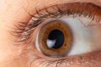 ژنی که کلید درمان یک بیماری نادر چشمی است