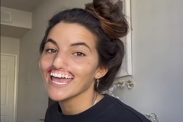 سگ ، لب های این دختر را خورد (عکس) سگ ، لب های این دختر را خورد (عکس)