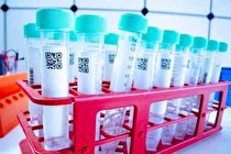 جدیدترین فهرست آزمایشگاه های تشخیص کرونا