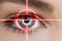 چرا صبح ها چشممان تار می بیند؟