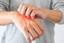 چرا پوستتان می‌خارد؟