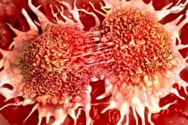 نشانه‌ های اولیه سرطان خون چیست؟