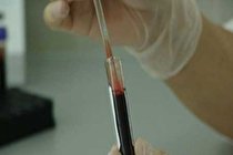 روش جدید برای کشف سریع‌تر داروهای ضد سرطان